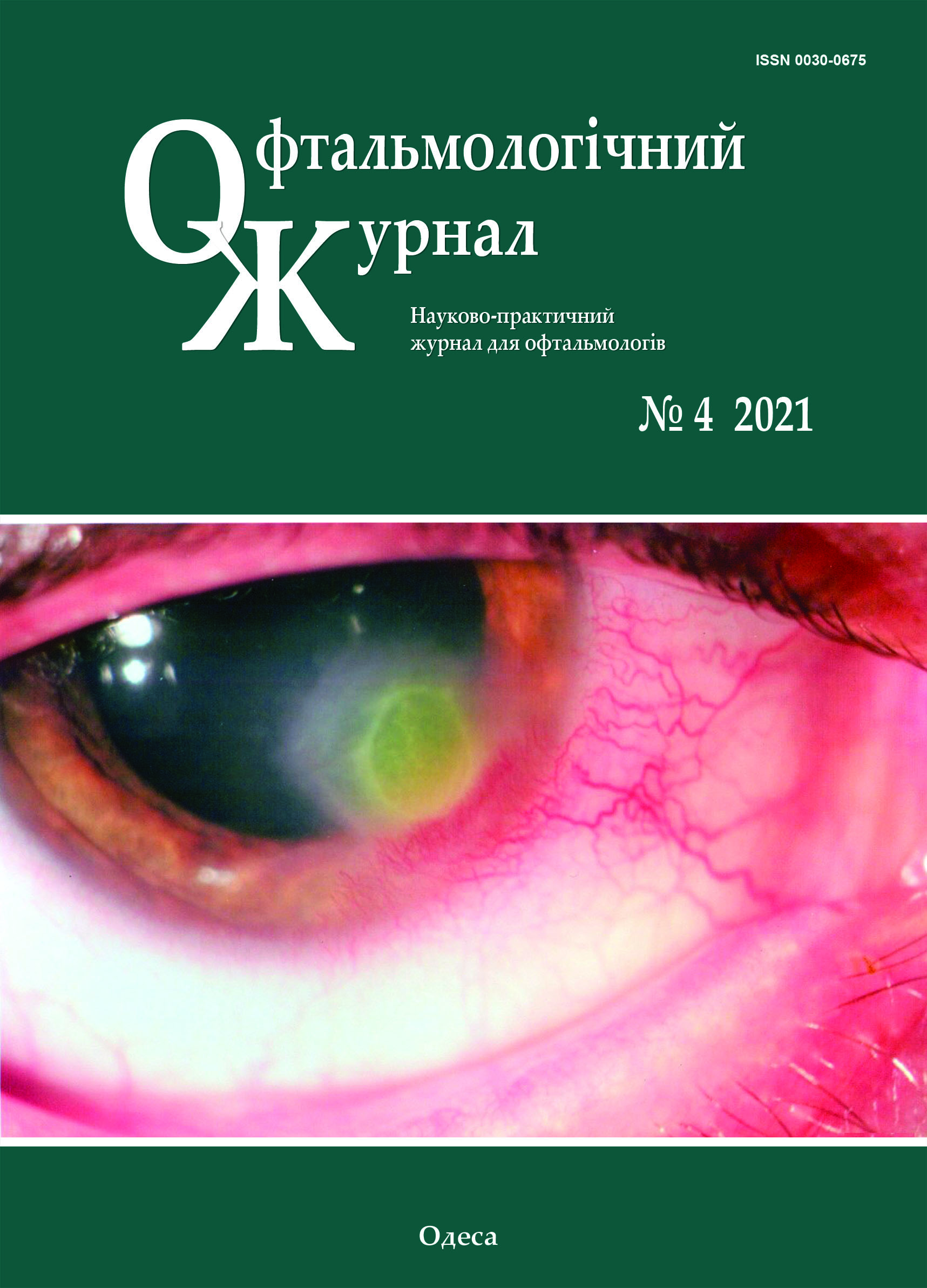 					View Vol. 501 No. 4 (2021): Journal of Ophthalmology (Ukraine)
				