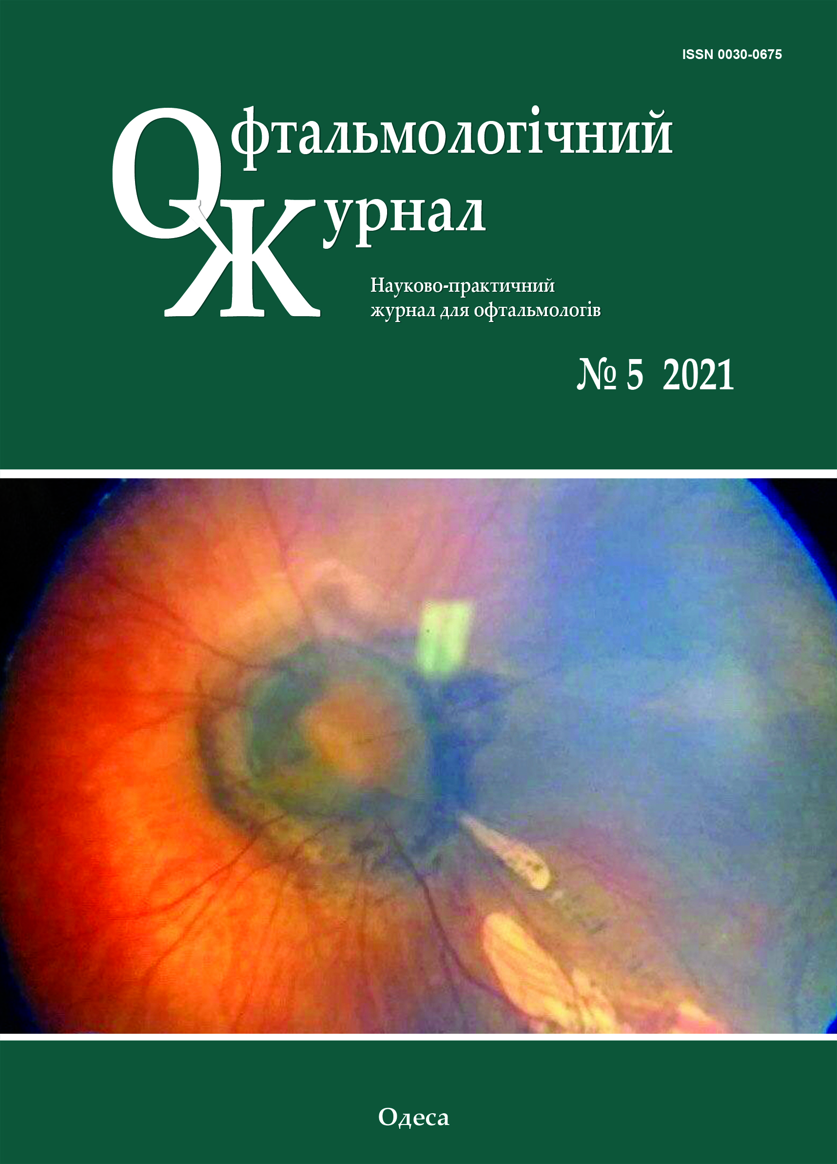 					View Vol. 502 No. 5 (2021): Journal of Ophthalmology (Ukraine)
				