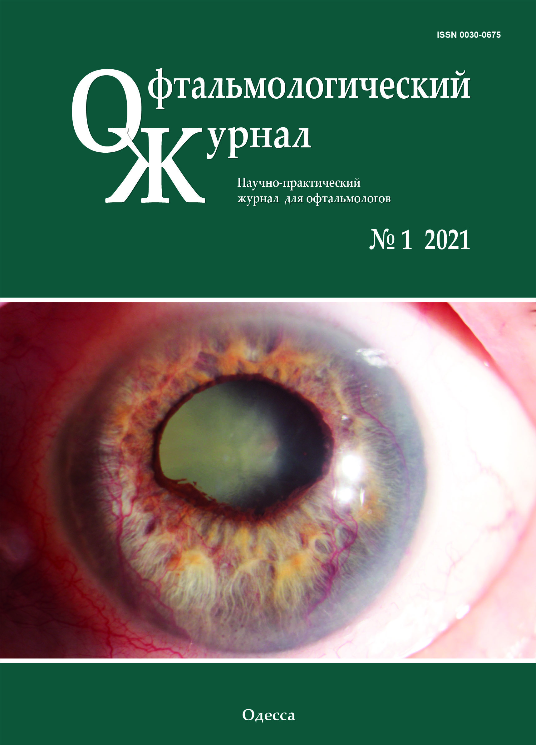 					View Vol. 498 No. 1 (2021): Journal of Ophthalmology (Ukraine)
				