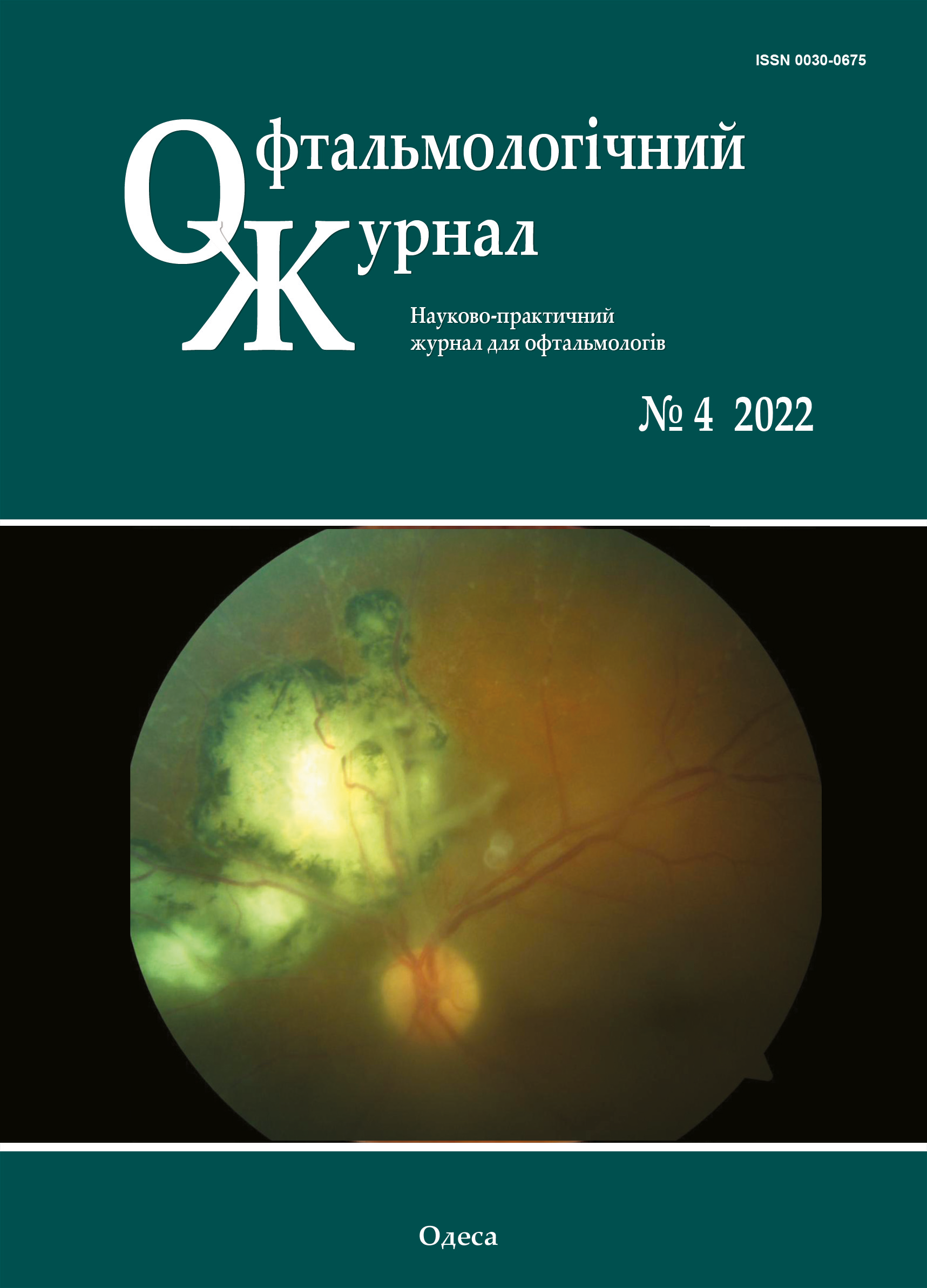 					View Vol. 507 No. 4 (2022): Journal of Ophthalmology (Ukraine)
				