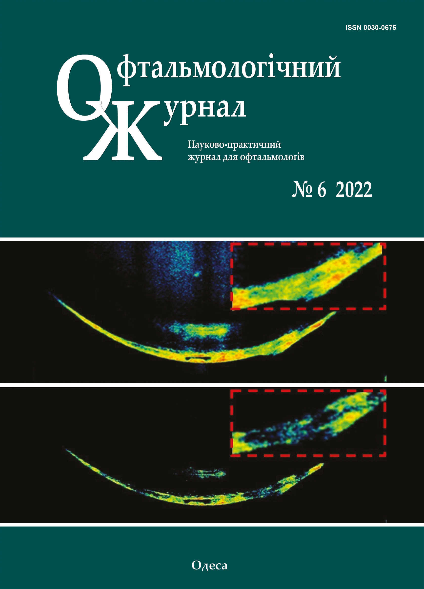 					View No. 6 (2022): Journal of Ophthalmology (Ukraine)
				