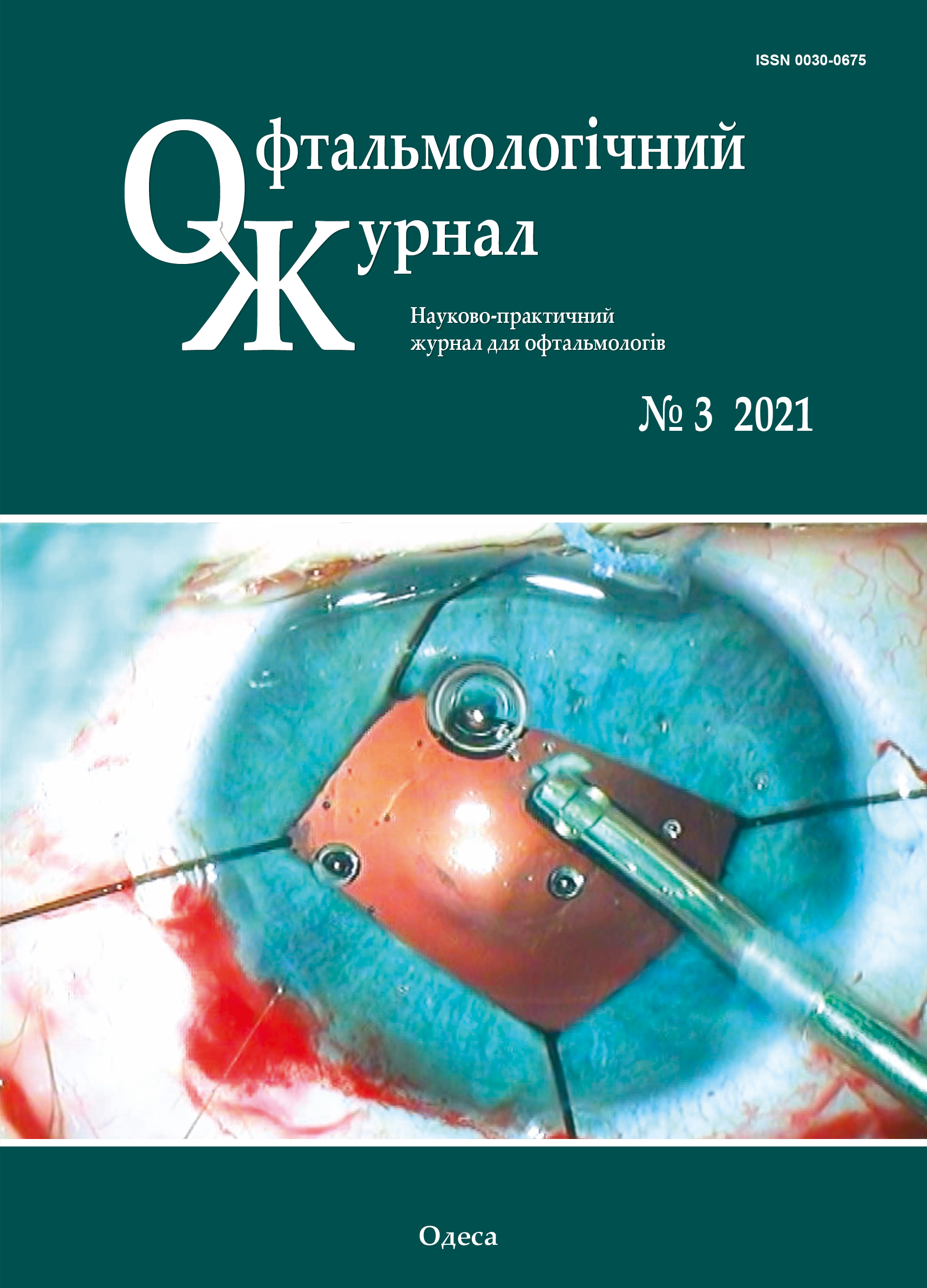 					View Vol. 500 No. 3 (2021): Journal of Ophthalmology (Ukraine)
				